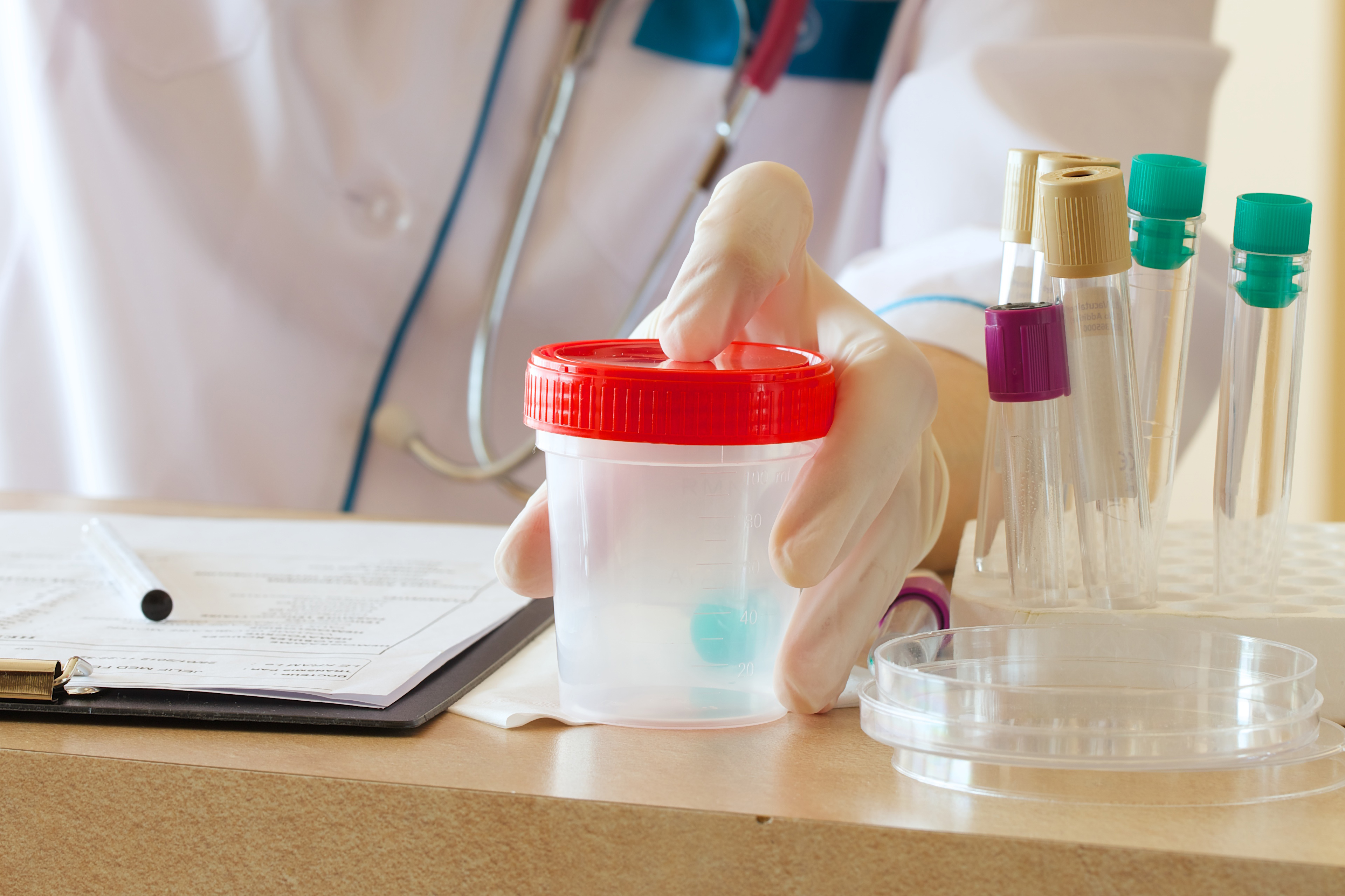 Workplace drug and alcohol screening